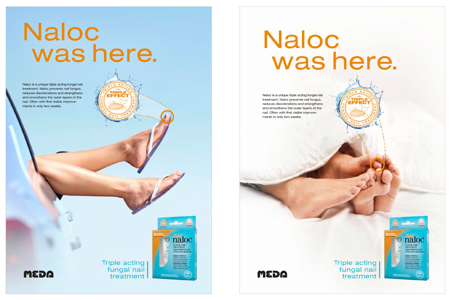 Naloc_2